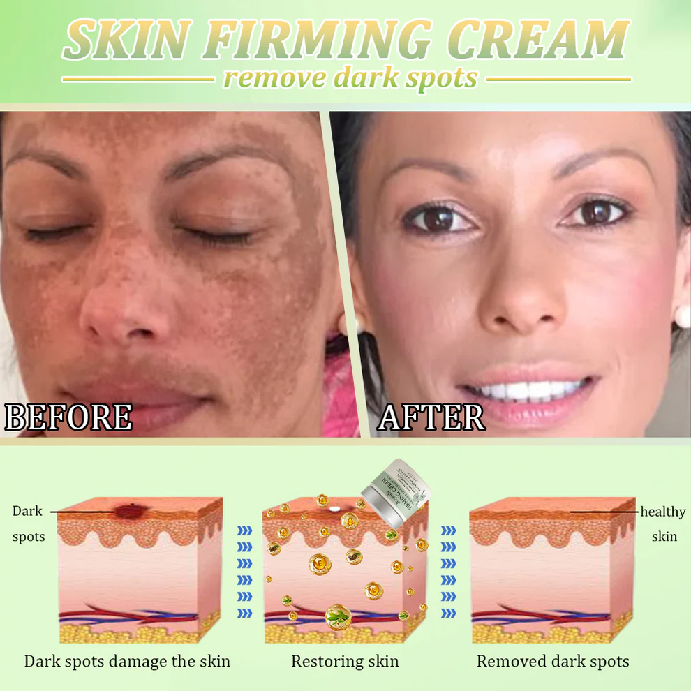 Jorondy® Skin Firming Cream 10 Jorondy® Skin Firming Cream