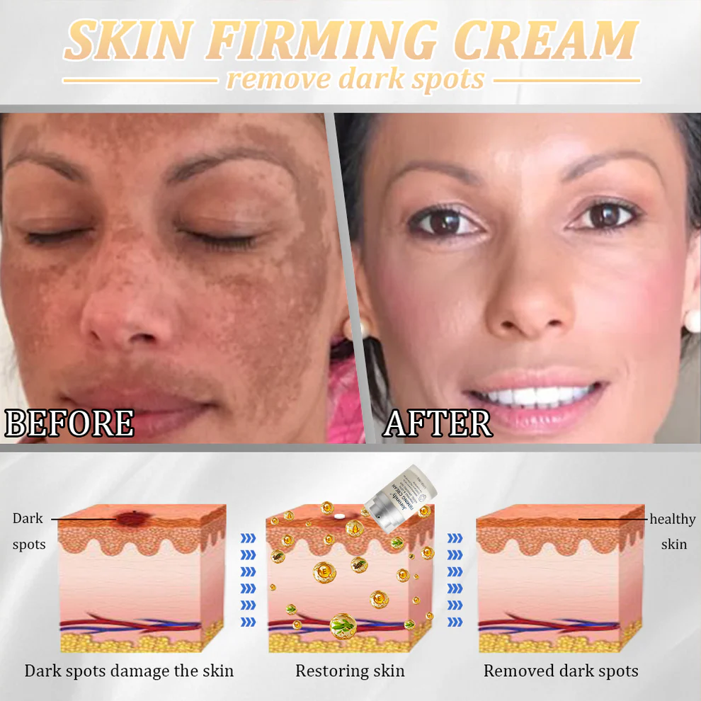 Jorondy® Erase Sagging Skin – The Ancient Herbal Formula Clinically Proven to Firm in Just Weeks 8 Jorondy® Erase Sagging Skin – The Ancient Herbal Formula Clinically Proven to Firm in Just Weeks