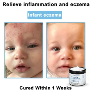 Ourlyard® Magnesium skin repair cream 21 Ourlyard® Magnesium skin repair cream