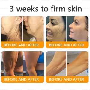 APKAPK® Bee venom Comprehensive Cream 20 APKAPK® Bee venom Comprehensive Cream