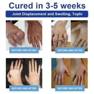 Cvreoz® JointRenew Joint Care Gel Roller Ball