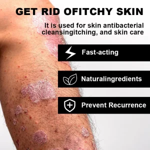 NESLEMY™ Psoriasis Cure Cream, relieves itching and restores smooth and youthful skin 18 NESLEMY™ Psoriasis Cure Cream, relieves itching and restores smooth and youthful skin