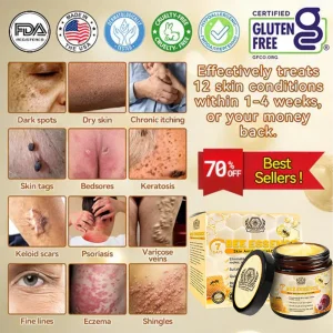 LOVILDS™ Bee Essence Skin Antibacterial Cream