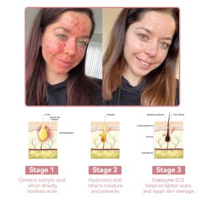 Awzlove™ Coenzyme Q10 Collagen Jelly Skin Cream 14 Coenzyme Q10 Collagen Jelly Skin Cream