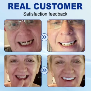 Nurbini™ Advanced Customized Full Denture Set 21 Nurbini™ Advanced Customized Full Denture Set