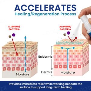 ATTDX® Apis Venom Hemorrhoid Cooling Spray 17 Cvreoz® Genital Treatment Spray