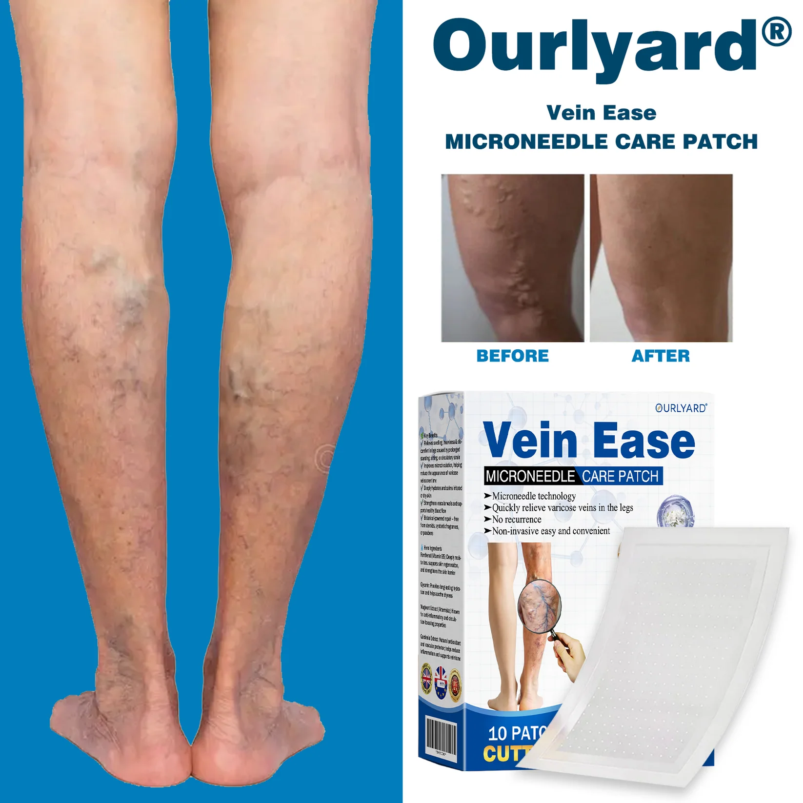 Ourlyard® Vein Ease Microneedle Care Patch - Cuttable 10 Ourlyard® Vein Ease Microneedle Care Patch - Cuttable - Image 10