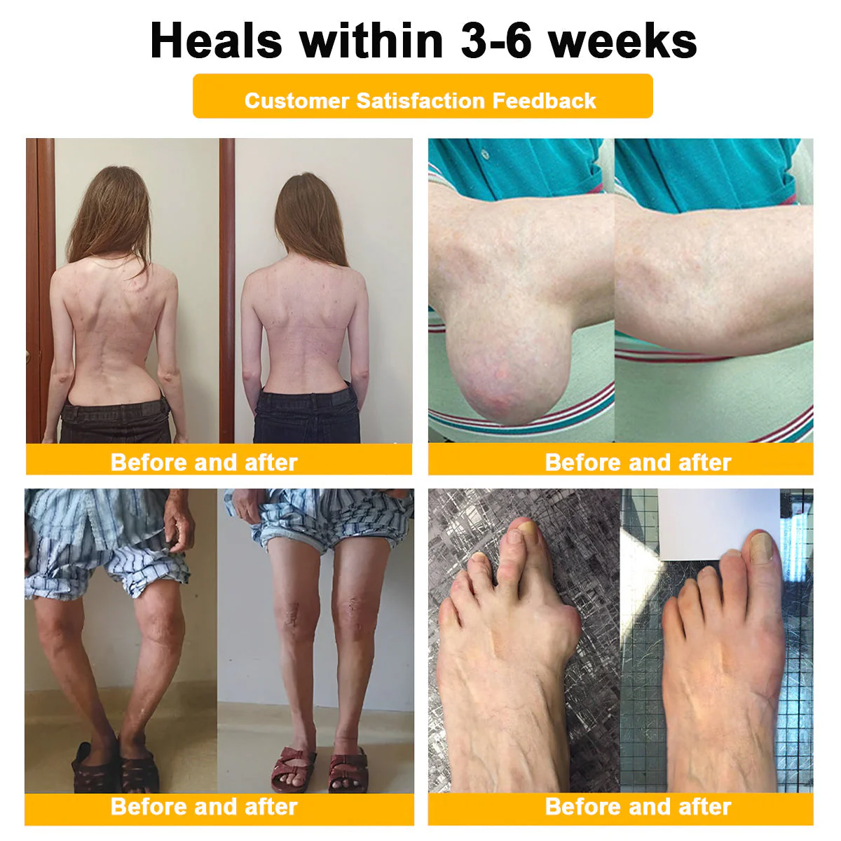 ODALIT™ Botulinum Toxin & Bee Venom Pain-Relief Bone Healing Cream 13 ODALIT™ Botulinum Toxin & Bee Venom Pain-Relief Bone Healing Cream - Image 13