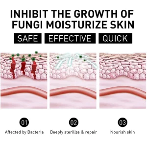 NESLEMY™ Psoriasis Cure Cream, relieves itching and restores smooth and youthful skin 16 NESLEMY™ Psoriasis Cure Cream, relieves itching and restores smooth and youthful skin