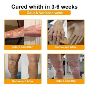 XRLXRL™ Bee Venom Pain-Relief Bone Healing Cream 20 XRLXRL™ Bee Venom Pain-Relief Bone Healing Cream