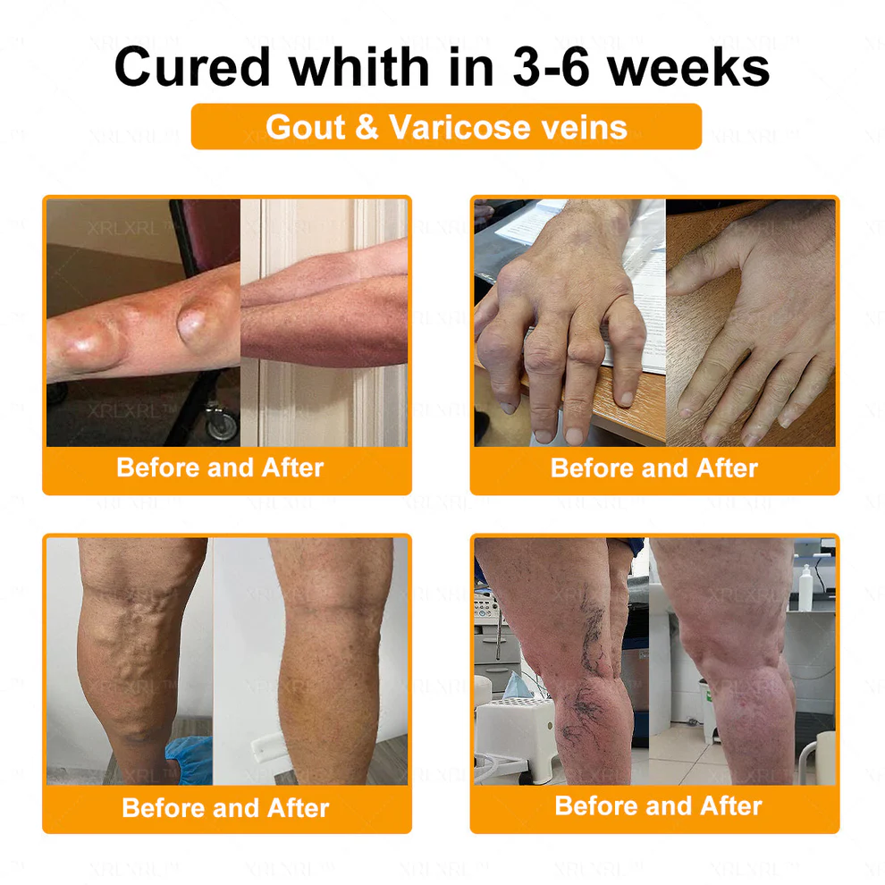 XRLXRL™ Bee Venom Pain-Relief Bone Healing Cream 5 XRLXRL™ Bee Venom Pain-Relief Bone Healing Cream