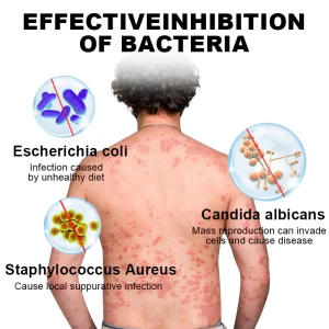 NESLEMY™ Psoriasis Cure Cream, relieves itching and restores smooth and youthful skin 17 NESLEMY™ Psoriasis Cure Cream, relieves itching and restores smooth and youthful skin