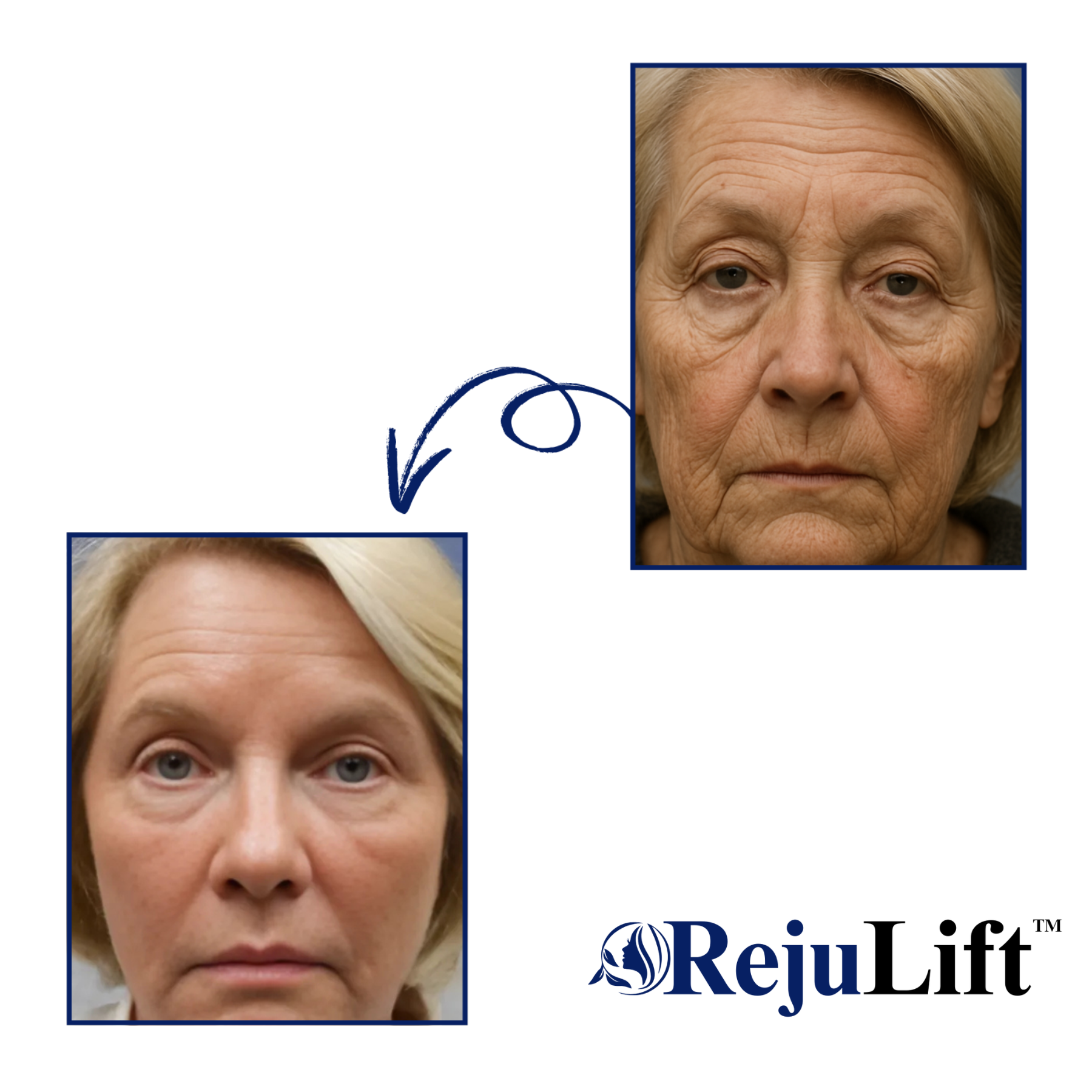 RejuLift™ Lifting Serum | Facelift without Botox 3 RejuLift™ Lifting Serum | Facelift without Botox - Image 3