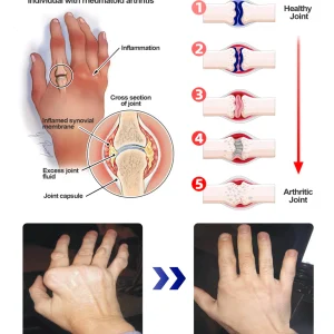 ADFIRE® Dual Action Pain Relief