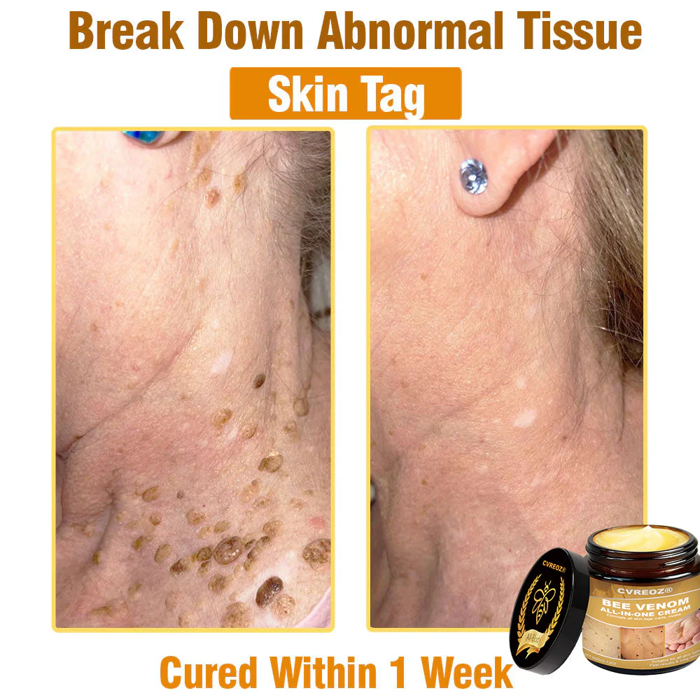 Cvreoz® Bee Venom All-in-One Cream 2 Cvreoz® Bee Venom All-in-One Cream