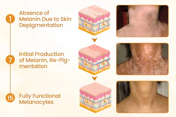 Newyuo® VitiCalm Bee Venom Cream 6 Newyuo® VitiCalm Bee Venom Cream