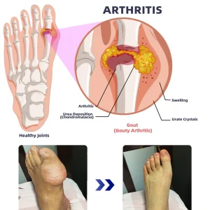 ADFIRE® Dual Action Pain Relief