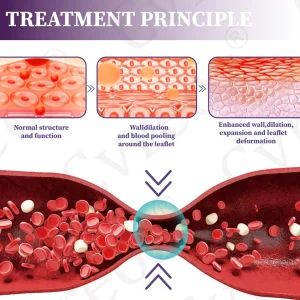 Cvreoz®DiaLeg Care Phyto Cream