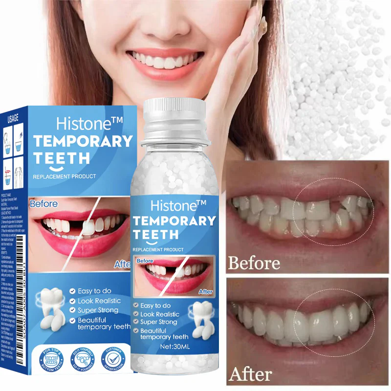 Histone™ Natural Tooth Repair Gel 2 Histone™ Natural Tooth Repair Gel