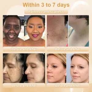 JORONDY® Bee Bright Kolirin Advanced Cream 13 JORONDY® Bee Bright Kolirin Advanced Cream