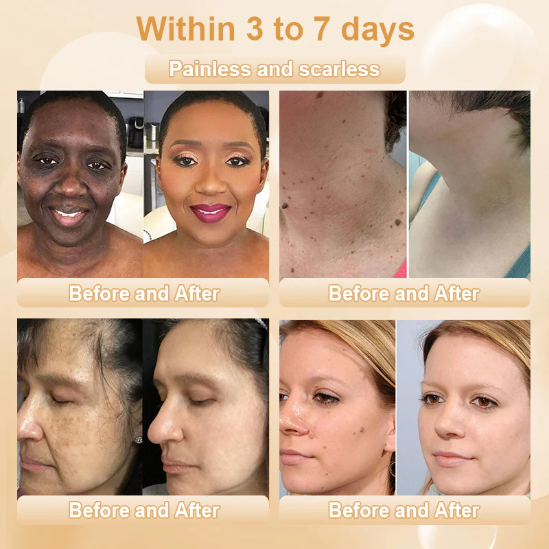 JORONDY® Bee Bright Kolirin Advanced Cream 4 JORONDY® Bee Bright Kolirin Advanced Cream