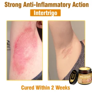 Cvreoz® Bee Venom All-in-One Cream 18 Cvreoz® Bee Venom All-in-One Cream