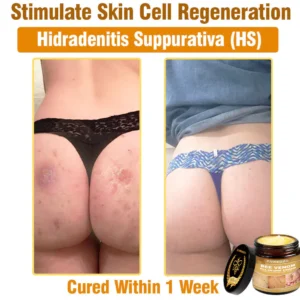 Cvreoz® Bee Venom All-in-One Cream 19 Cvreoz® Bee Venom All-in-One Cream