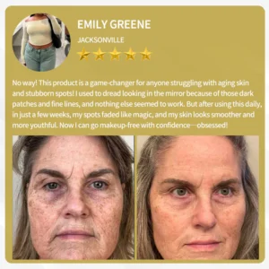 LOVILDS™ Bee Venom Cream — Trusted by Millions for Healthy, Glowing Skin 25 LOVILDS™ Bee Venom Cream — Trusted by Millions for Healthy, Glowing Skin