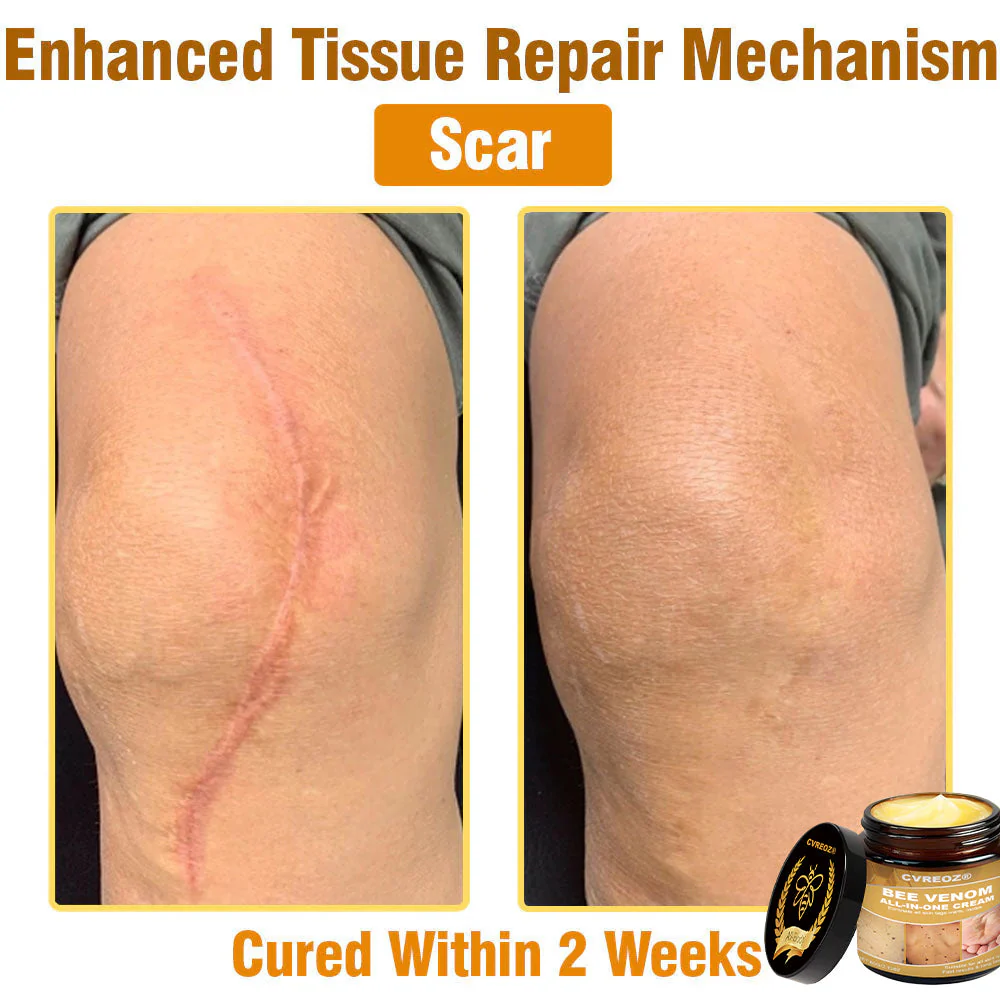 Cvreoz® Bee Venom All-in-One Cream 8 Cvreoz® Bee Venom All-in-One Cream - Image 8