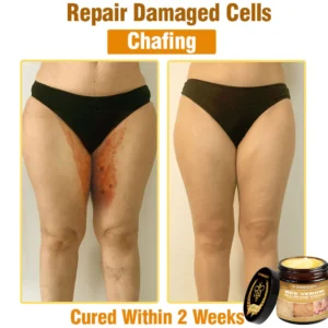 Cvreoz® Bee Venom All-in-One Cream 21 Cvreoz® Bee Venom All-in-One Cream