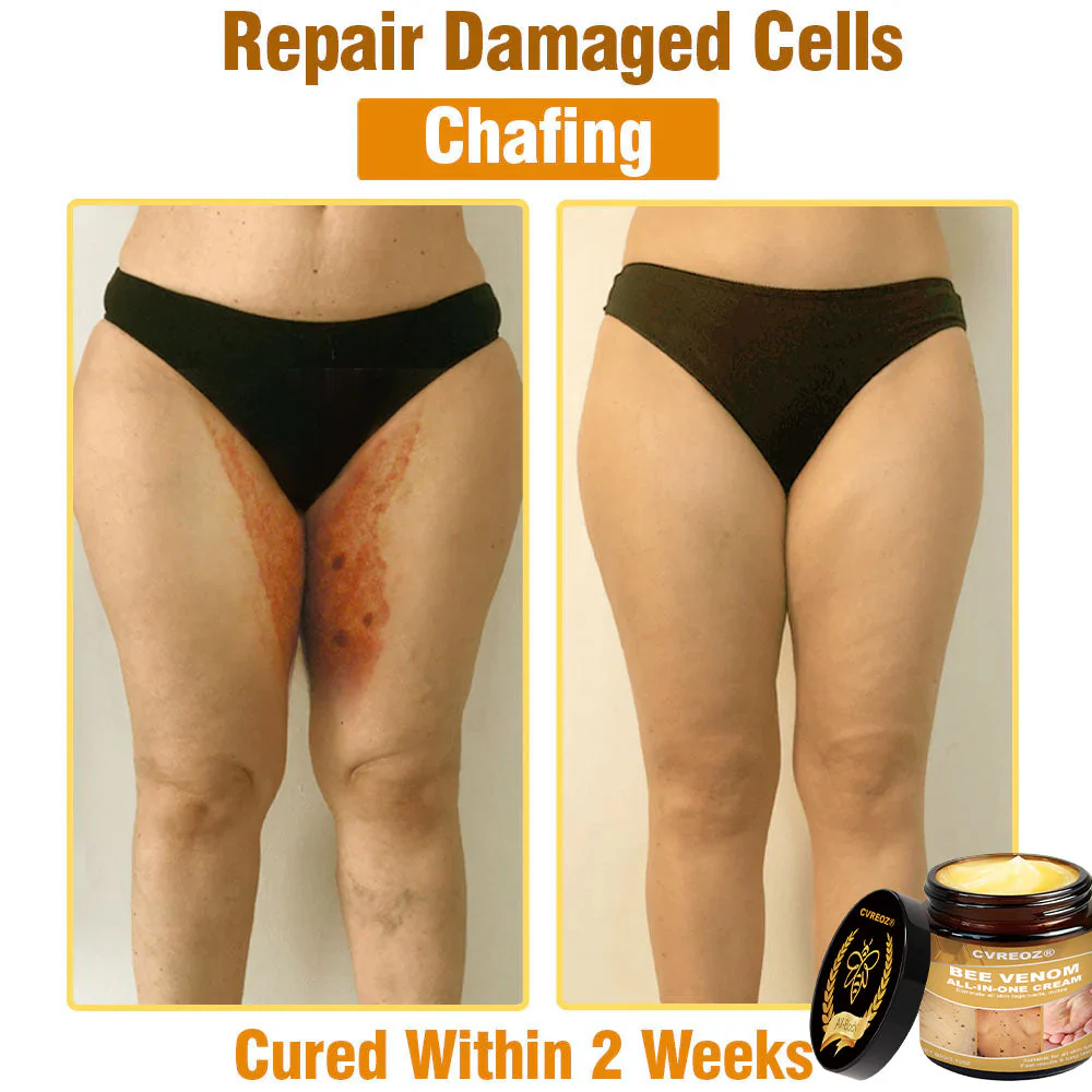 Cvreoz® Bee Venom All-in-One Cream 9 Cvreoz® Bee Venom All-in-One Cream - Image 9