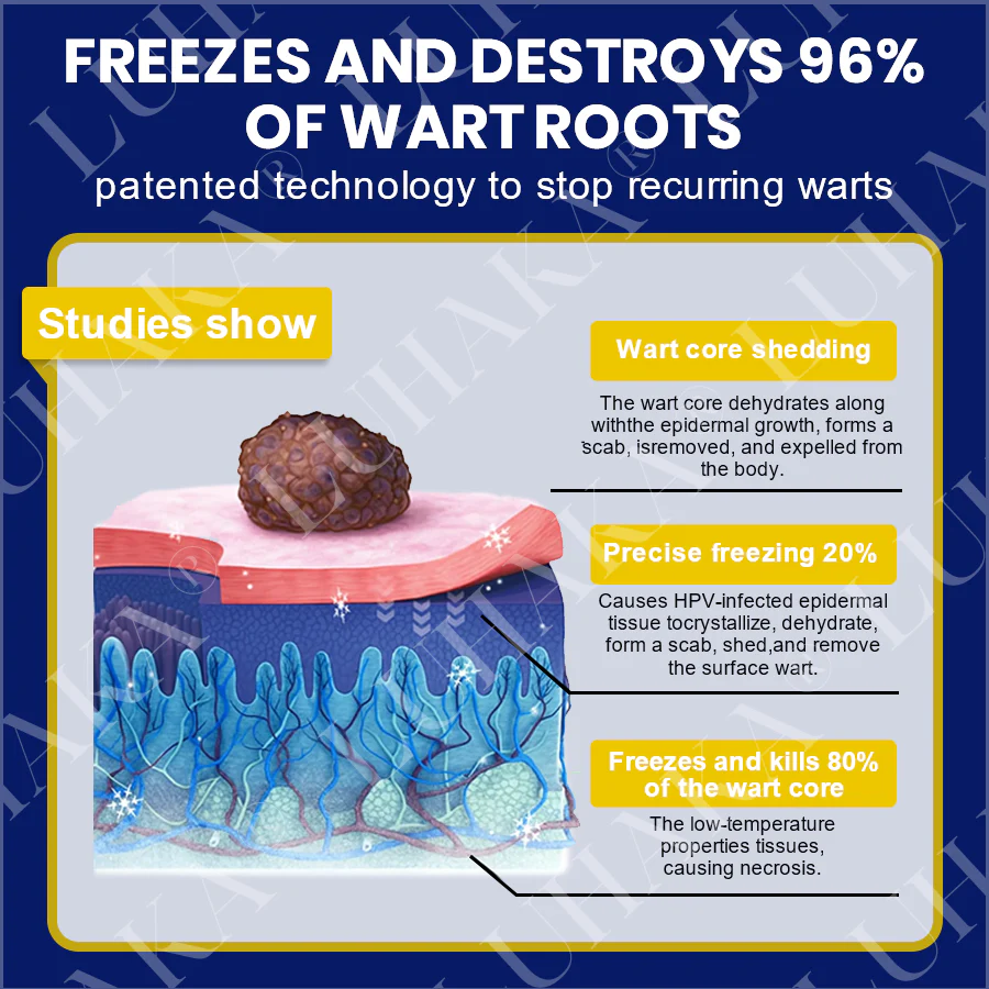 LUHAKA® SKIN TAG CRYO TREATMENT SPRAY ACE 7 LUHAKA® SKIN TAG CRYO TREATMENT SPRAY ACE