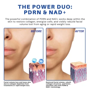 Fivfivgo® PDRN-NAD+ Cica Reedle Shot Serum 9 Fivfivgo® PDRN-NAD+ Cica Reedle Shot Serum