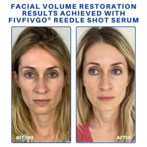 Fivfivgo® PDRN-NAD+ Cica Reedle Shot Serum 11 Fivfivgo® PDRN-NAD+ Cica Reedle Shot Serum