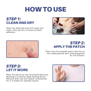 Fivfivgo® Microneedle HPV Genital Warts Removal Patch