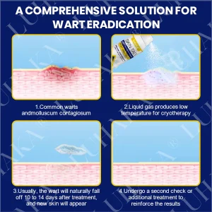 LUHAKA® SKIN TAG CRYO TREATMENT SPRAY ACE 16 LUHAKA® SKIN TAG CRYO TREATMENT SPRAY ACE