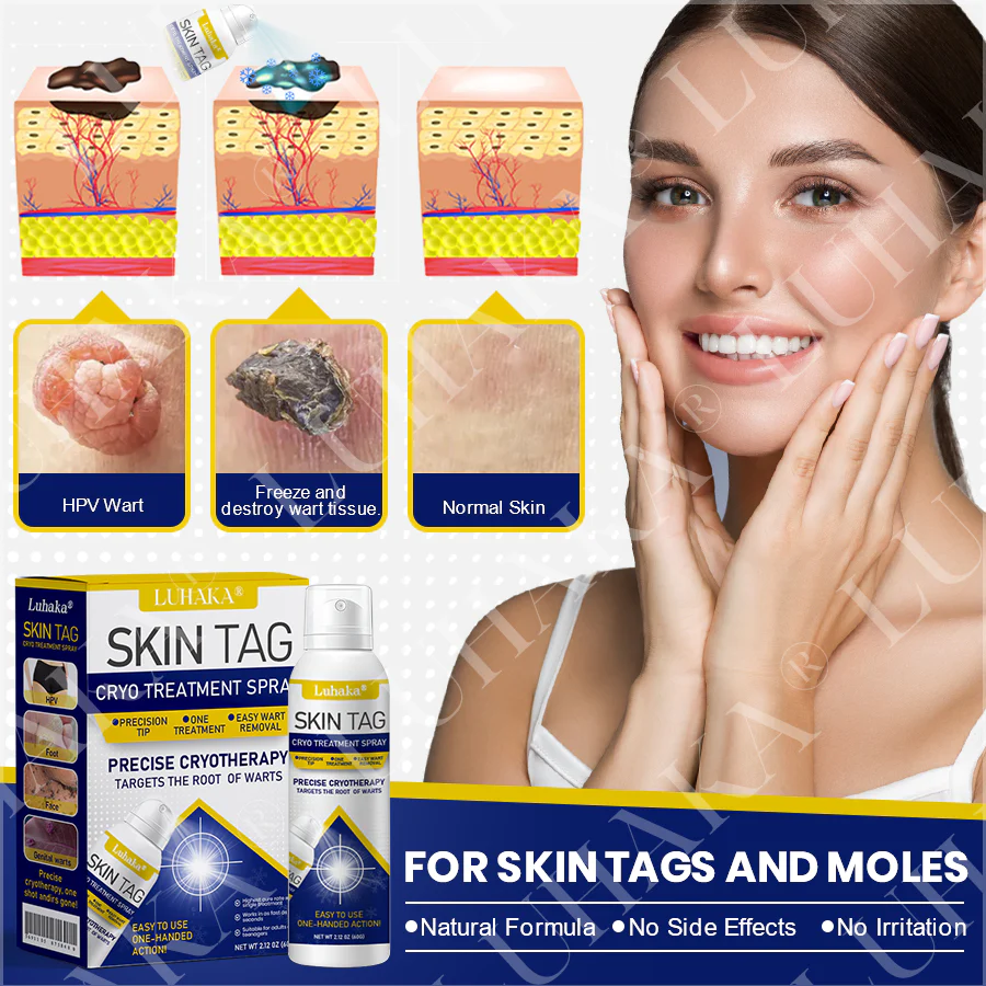 LUHAKA® SKIN TAG CRYO TREATMENT SPRAY ACE 2 LUHAKA® SKIN TAG CRYO TREATMENT SPRAY ACE