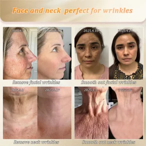 Jorondy® Anti-Glycation Skin Firming Cream 17 Jorondy® Anti-Glycation Skin Firming Cream