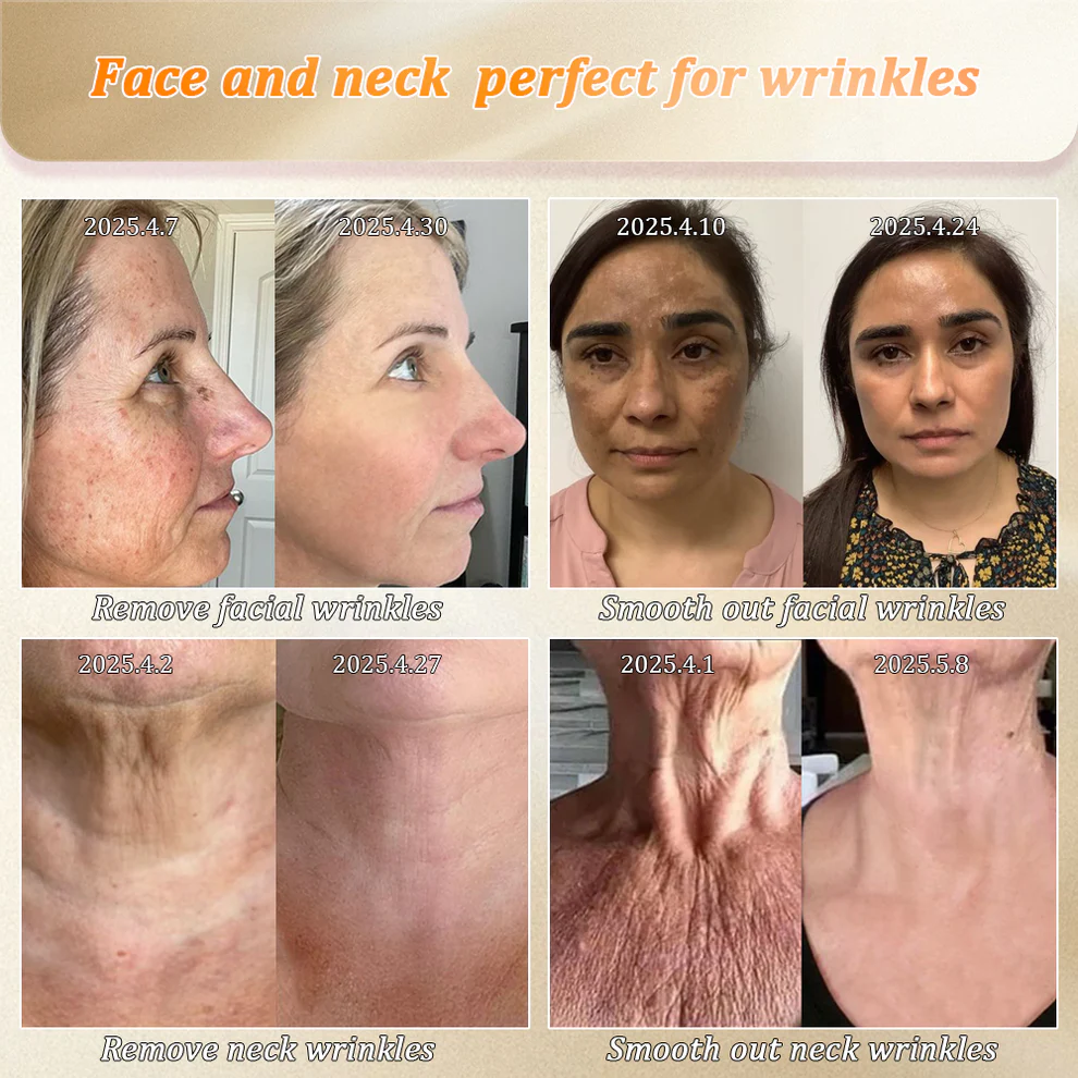 Jorondy® Anti-Glycation Skin Firming Cream 3 Jorondy® Anti-Glycation Skin Firming Cream