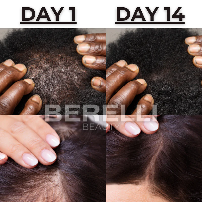 Berelli© Hair Growth Scalp Ampoule 2 Berelli© Hair Growth Scalp Ampoule