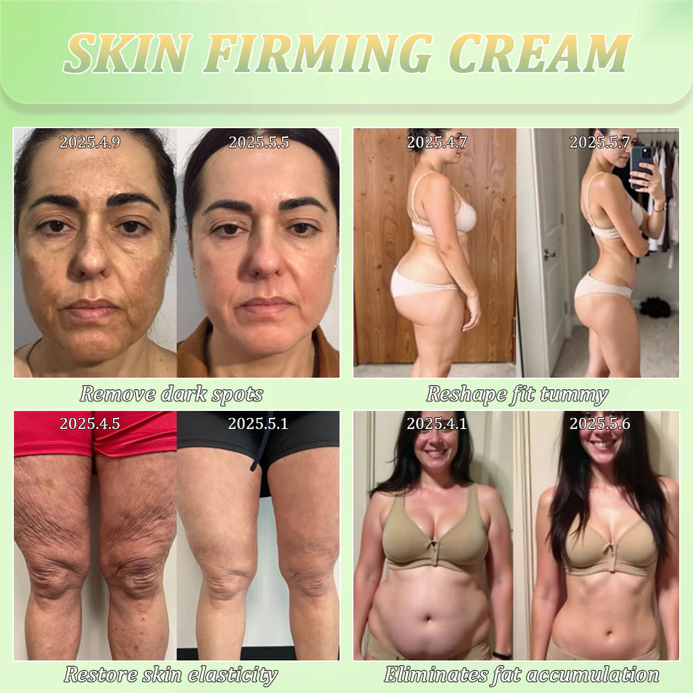 Jorondy® Skin Firming Cream 6 Jorondy® Skin Firming Cream