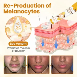 Newyuo® VitiCalm Bee Venom Cream 14 Newyuo® VitiCalm Bee Venom Cream