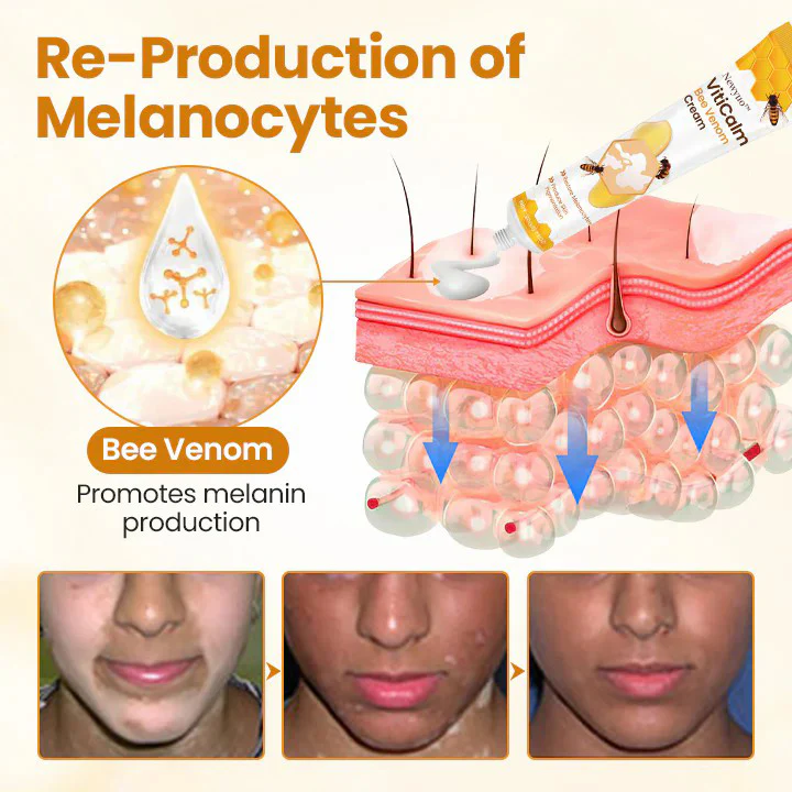 Newyuo® VitiCalm Bee Venom Cream 5 Newyuo® VitiCalm Bee Venom Cream