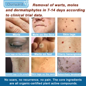 Ourlyard® Magnesium skin repair cream 14 Ourlyard® Magnesium skin repair cream