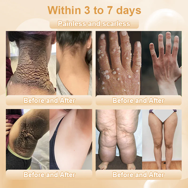 JORONDY® Bee Bright Kolirin Advanced Cream 5 JORONDY® Bee Bright Kolirin Advanced Cream