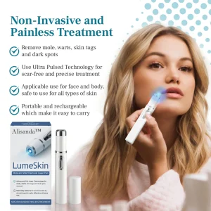 Alisanda™ LumeSkin Mole and Wart Removal Laser Pen 14 Alisanda™ LumeSkin Mole and Wart Removal Laser Pen