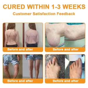 ZVLZVL® Bee Venom Pain-Relief Bone Healing Cream 14 ZVLZVL® Bee Venom Pain-Relief Bone Healing Cream