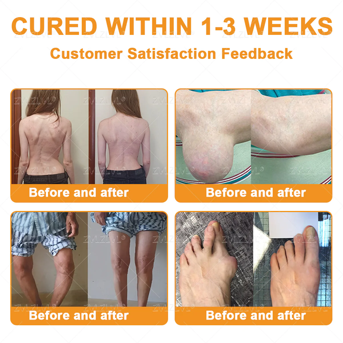 ZVLZVL® Bee Venom Pain-Relief Bone Healing Cream 4 ZVLZVL® Bee Venom Pain-Relief Bone Healing Cream - Image 4