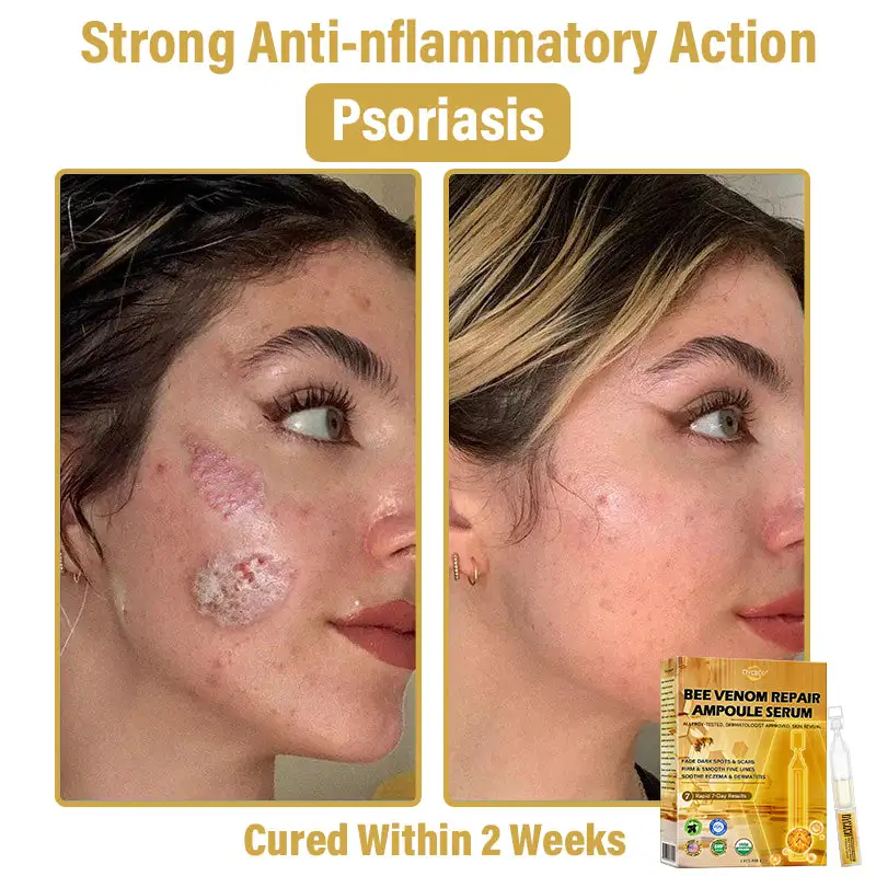 Dyceco® Bee Venom Skin Repair Ampoule Serum 3 Dyceco® Bee Venom Skin Repair Ampoule Serum - Image 3