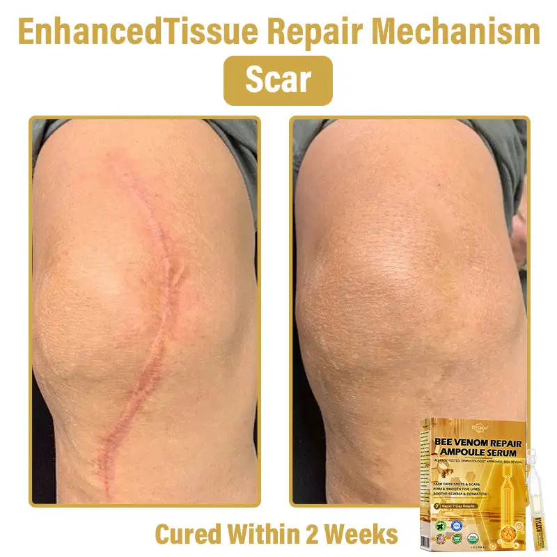 Dyceco® Bee Venom Skin Repair Ampoule Serum 6 Dyceco® Bee Venom Skin Repair Ampoule Serum - Image 6